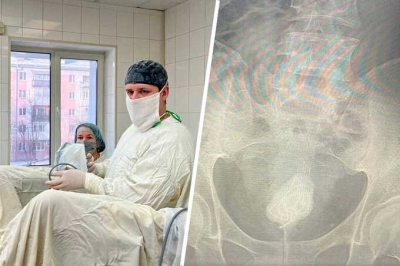 Россиянин получил травму мочевого пузыря, поскользнувшись на улице